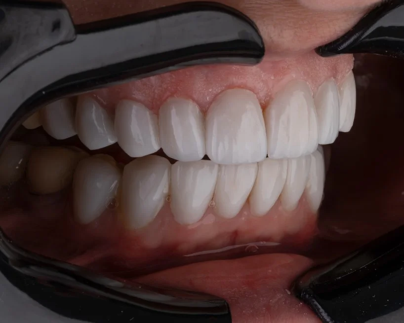 Boks Dişliği Nedir? Ne İşe Yarar? Nasıl Kullanılır?